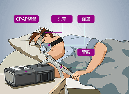 睡眠管家