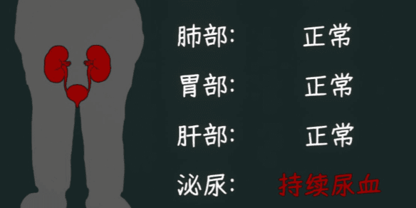 全结局攻略配图1
