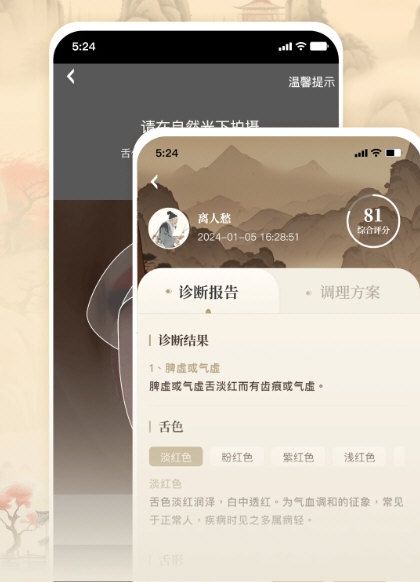 针灸穴位图解1