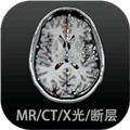 影像解剖图谱app